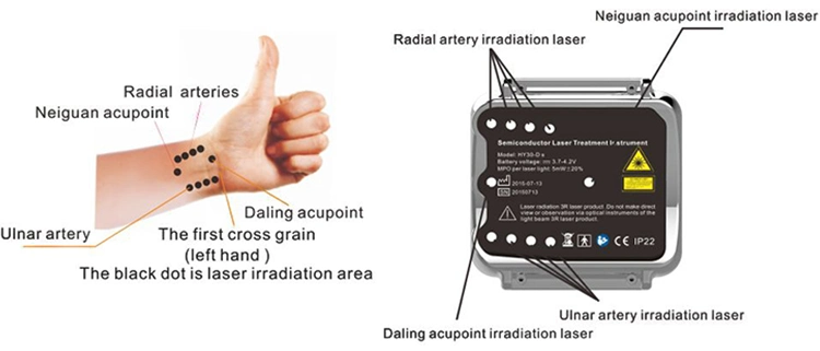 China Factory Offer Semiconductor Laser Watch for Blood Cleaning, Lower High Blood Fat, Cholesterol